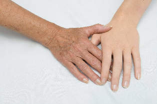 foryngelse af huden på hænder
