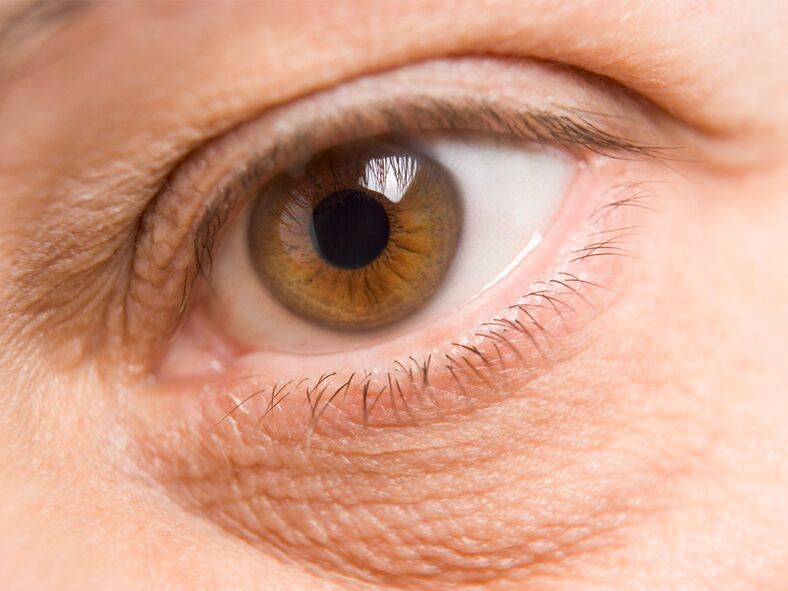 huden omkring øjnene og dens foryngelse med en laser