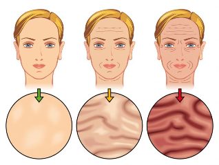 stadier af ældning af huden
