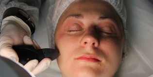 hvordan man forbereder sig på plasma hudforyngelsesproceduren
